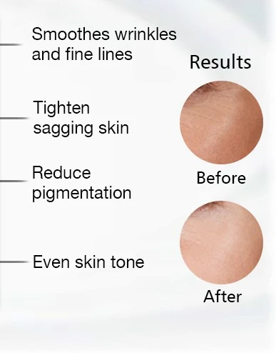 Skin Benefits of red light thrapy